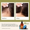 Gya Labs Argan Hair Revival Oil – 3.4 Fl Oz – for Hair, Skin & Face(Rosemary & Castor)