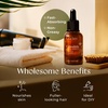 Prickly Pear Seed Oil – 1 Fl Oz – Carrier Oil for Hair, Skin, Face & Scalp(Calendula)